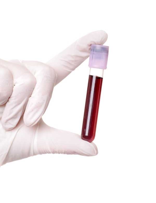 Home Collection Services - Blood Tests | Hyderabad