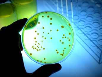 Microbiology tests - Hyderabad | HCS