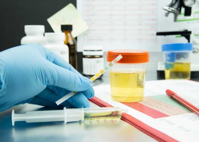 Urine test at home - HCS home collection services-Hyderabad